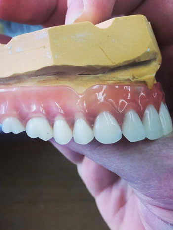 Sea Dent protez laboratuvarında üretim süreci