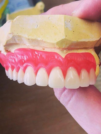 tam ve bölümlü hareketli protez İzmir