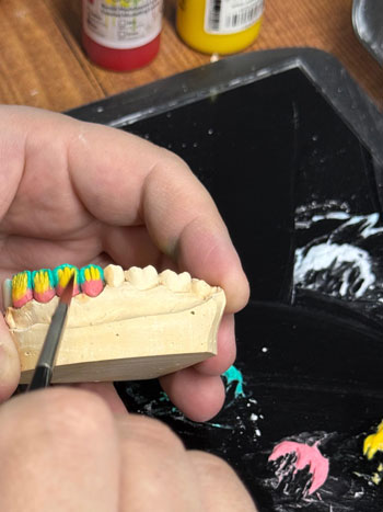 cad cam sabit protez üretimi İzmir